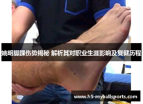 姚明脚踝伤势揭秘 解析其对职业生涯影响及复健历程